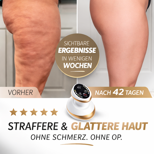 JunaVie Cellulite Behandlung