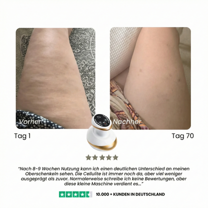 JunaVie Cellulite Behandlung