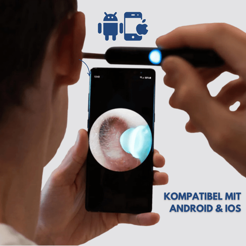 JunaVie Intelligenter Ohrenreiniger mit Kamera